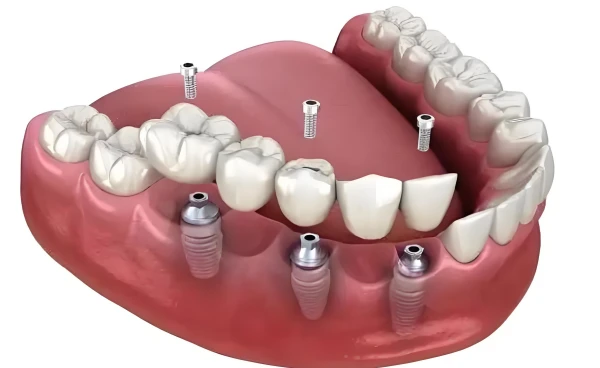 info-600-368 info-600-368